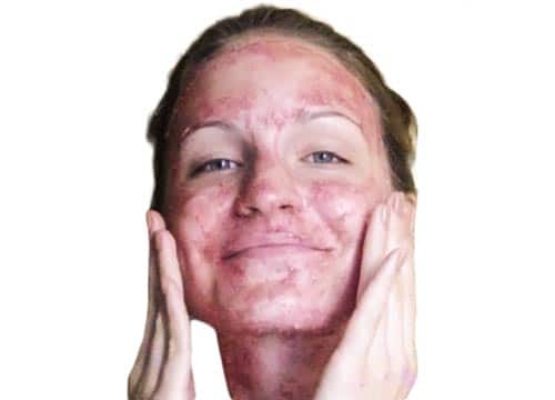 face mask made of currants